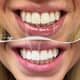 Slider image (9) A-Dent Dental Clinic in Antalya, Turkey